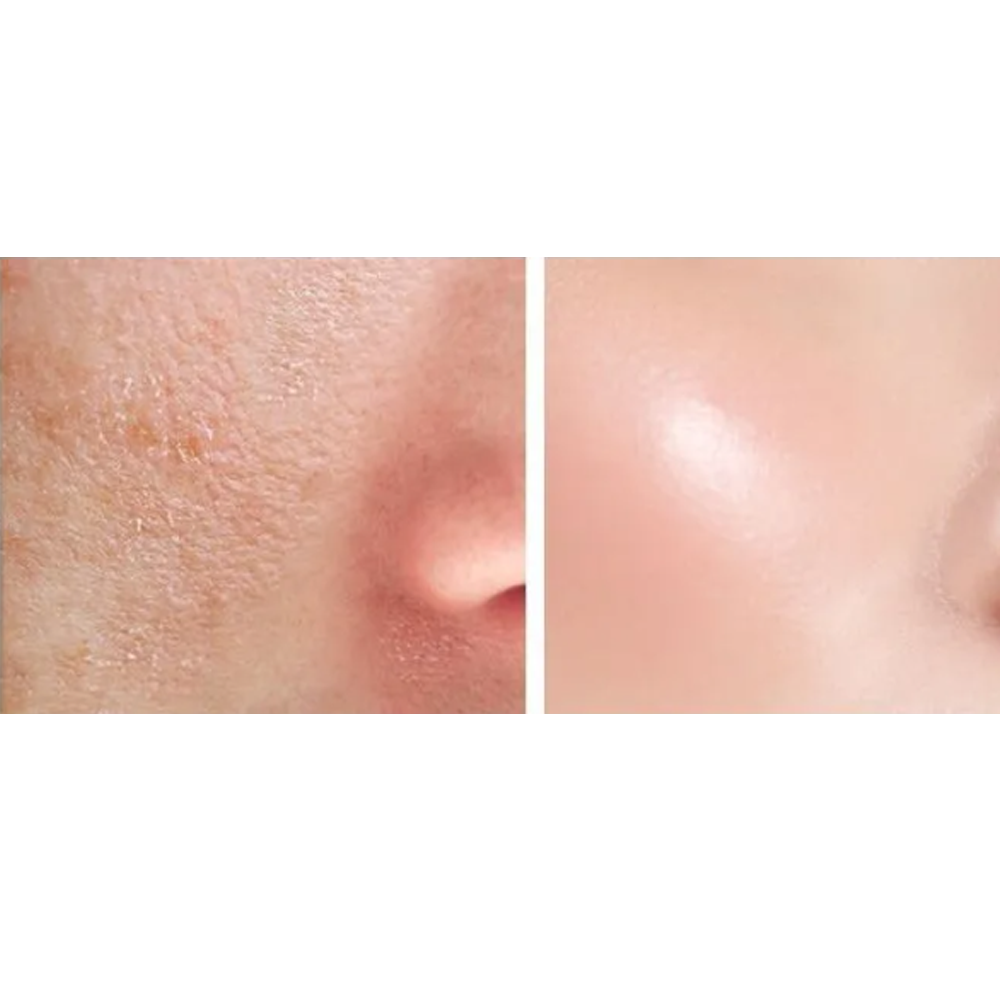 The cream features a blend of Cica and snail mucin to soothe, repair, and hydrate the skin. 