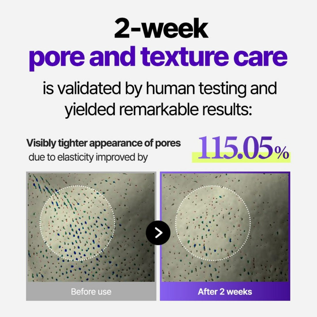 A powerful ingredient for brightening the skin and improving uneven skin tone.